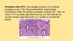 Prezentācija 'Prostatas vēzis', 2.