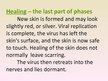 Prezentācija 'Herpes Viruses', 20.