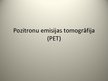 Prezentācija 'Pozitronu emisijas tomogrāfija un ultrasonogrāfija', 2.