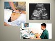 Prezentācija 'Pozitronu emisijas tomogrāfija un ultrasonogrāfija', 17.