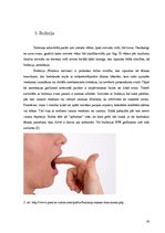 Referāts 'Uztura problēmas pusaudžiem', 19.