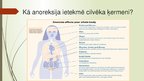 Prezentācija 'Anoreksija', 13.