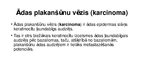 Prezentācija 'Onkoloģijas problēmas', 33.