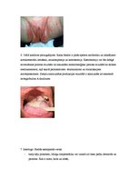 Konspekts 'Kandidoze', 3.