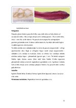 Referāts 'Medicīniskā parazitoloģija. Helmintozes', 32.