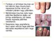 Prezentācija 'Roku nagi', 5.