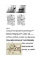 Referāts 'Neiroķirurģisko operāciju apraksti', 15.