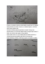 Referāts 'Neiroķirurģisko operāciju apraksti', 21.