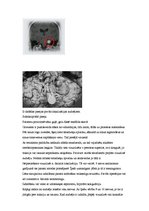 Referāts 'Neiroķirurģisko operāciju apraksti', 26.