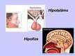 Prezentācija 'Hipofīze', 3.