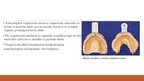 Prezentācija 'Izņemamās parciālās zobu protēzes ar plastmasas bāzi izgatavošanas klīniskie, la', 4.