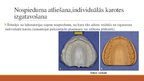Prezentācija 'Izņemamās parciālās zobu protēzes ar plastmasas bāzi izgatavošanas klīniskie, la', 6.