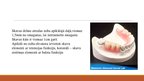 Prezentācija 'Izņemamās parciālās zobu protēzes ar plastmasas bāzi izgatavošanas klīniskie, la', 21.