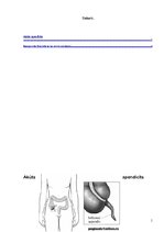 Konspekts 'Akūts apendicīts', 1.