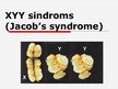 Prezentācija 'XYY - sindroms', 1.