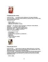 Referāts 'Lakas', 10.