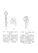 Referāts 'Cilvēka smadzenes', 28.