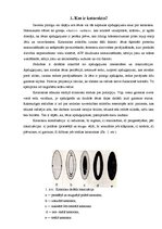 Konspekts 'Acu slimība - katarakta', 2.