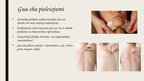 Prezentācija 'Gua-sha masāžas terapija', 3.