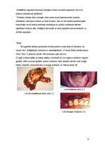 Referāts 'Smēķēšana pusaudžu vidū', 13.