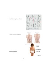 Referāts 'Korsete - palīglīdzeklis idioptiskās skoliozes ārstēšanai pusaudžu vecumā', 21.