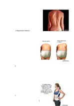 Referāts 'Korsete - palīglīdzeklis idioptiskās skoliozes ārstēšanai pusaudžu vecumā', 22.