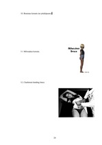 Referāts 'Korsete - palīglīdzeklis idioptiskās skoliozes ārstēšanai pusaudžu vecumā', 24.