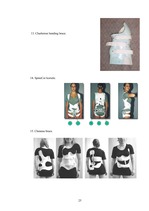 Referāts 'Korsete - palīglīdzeklis idioptiskās skoliozes ārstēšanai pusaudžu vecumā', 25.