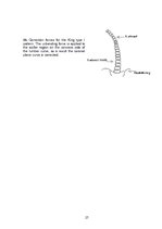 Referāts 'Korsete - palīglīdzeklis idioptiskās skoliozes ārstēšanai pusaudžu vecumā', 28.