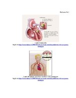 Diplomdarbs 'Mutes veselības nozīme pie sirds un asinsrites slimībām', 40.