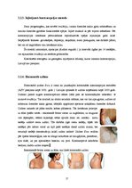 Referāts 'Kontracepcija', 17.