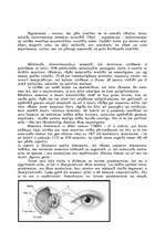 Referāts 'Dators un acs', 2.