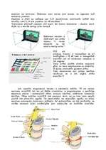 Referāts 'Dators un acs', 4.
