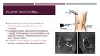 Prezentācija 'Priekšējo krustenisko saišu, menisku traumatisks bojājums ceļa locītavā', 6.
