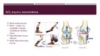 Prezentācija 'Priekšējo krustenisko saišu, menisku traumatisks bojājums ceļa locītavā', 10.