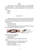 Referāts 'Datortīkli', 11.