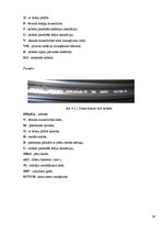 Referāts 'Telekomunikāciju tīkli ar simetrisko un optisko kabeli', 29.