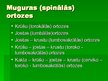 Prezentācija 'Ortrozes', 8.