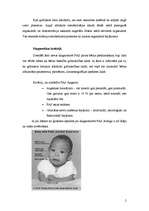 Referāts 'Embrionālais alkoholisma sindroms', 2.