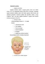 Referāts 'Embrionālais alkoholisma sindroms', 3.