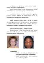 Referāts 'Embrionālais alkoholisma sindroms', 4.