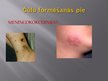 Prezentācija 'Meningokoku infekcija', 18.