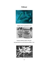 Referāts 'Seksuāli transmisīvās slimības', 15.