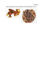 Referāts 'Nierakmeņu slimības diagnostika', 16.