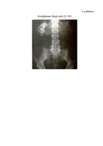Referāts 'Nierakmeņu slimības diagnostika', 18.