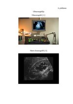 Referāts 'Nierakmeņu slimības diagnostika', 20.