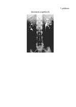 Referāts 'Nierakmeņu slimības diagnostika', 21.