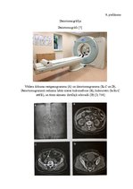 Referāts 'Nierakmeņu slimības diagnostika', 22.