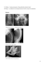 Referāts 'Paget`s Disease of Bone', 12.