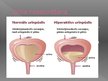 Prezentācija 'Urīnizvadorgāni', 5.
